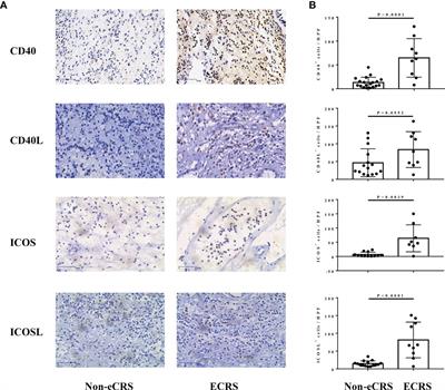 Involvement of CD40-CD40L and ICOS-ICOSL in the development of chronic rhinosinusitis by targeting eosinophils
